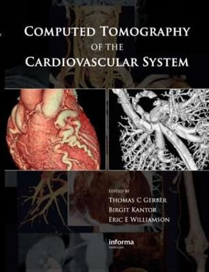 Computed Tomography of the Cardiovascular System - Thomas C. Gerber