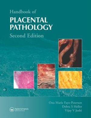 Handbook of Placental Pathology - Debra S. Heller