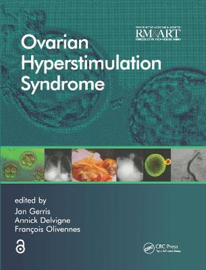 Ovarian Hyperstimulation Syndrome : Reproductive Medicine and Assisted Reproductive Techniques Series - Jan Gerris