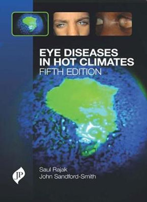 Eye Diseases in Hot Climates - Saul N Rajak