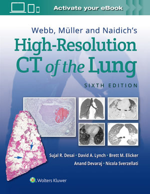 Webb, Muller and Naidich's High Resolution CT of the Lung : 6th Edition - Sujal Desai