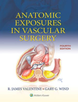 Anatomic Exposures in Vascular Surgery - R. James Valentine