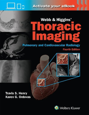 Webb & Higgins Thoracic Imaging : Print + eBook with Multimedia - Henry & Ordovas