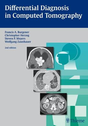 Differential Diagnosis in Computed Tomography : THIEME PUBLISHERS - Francis A. Burgener