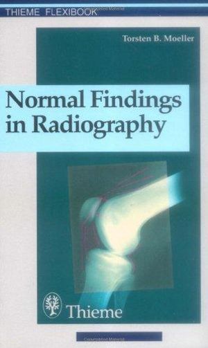 Normal Findings in Radiography : . Zus.-Arb.: Torsten B. Moller Translated by Terry Telger 190 Illustrations - Torsten Bert Moeller