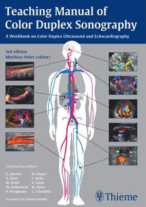 Teaching Manual of Color Duplex Sonography : THIEME PUBLISHERS - Matthias Hofer