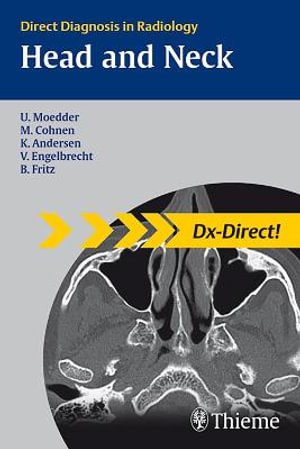 Head and Neck Imaging : Direct Diagnosis in Radiology - Ulrich Moedder