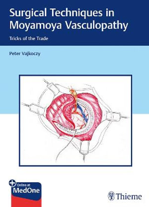 Surgical Techniques in Moyamoya Vasculopathy : Tricks of the Trade - Peter Vajkoczy