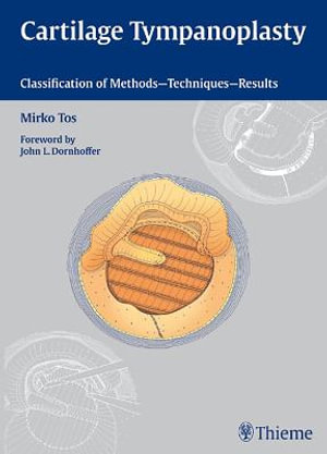 Cartilage Tympanoplasty : Classification of Methods - Techniques - Results - Mirko Tos