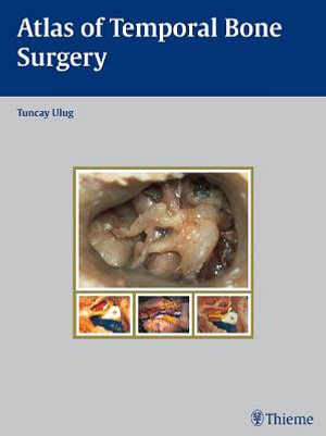 Atlas of Temporal Bone Surgery : THIEME PUBLISHERS - Tuncay Ulug