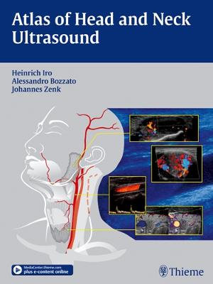 Atlas of Head and Neck Ultrasound - Heinrich Iro