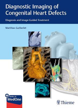 Diagnostic Imaging of Congenital Heart Defects : Diagnosis and Image-Guided Treatment - Matthias Gutberlet