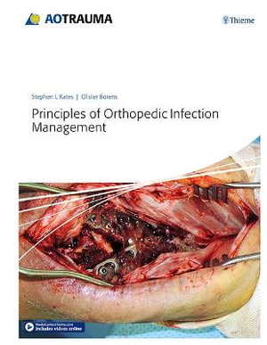 Principles of Orthopedic Infection Management - Stephen Kates