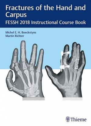 Fractures of the Hand and Carpus : FESSH 2018 Instructional Course Book - Michel E.H. Boeckstyns