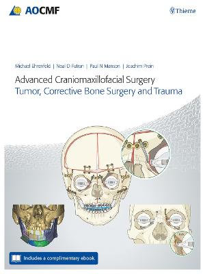 Advanced Craniomaxillofacial Surgery : Tumor, Corrective Bone Surgery, and Trauma - Michael Ehrenfeld