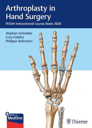 Arthroplasty in Hand Surgery : FESSH Instructional Course Book 2020 - Stephan Schindele