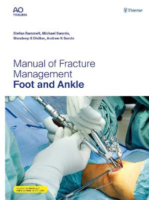 Manual of Fracture Management - Foot and Ankle - Stefan Rammelt