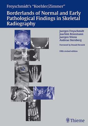 Freyschmidt's "Koehler/Zimmer" Borderlands of Normal and Early Pathological Findings in Skeletal Radiography - Juergen Freyschmidt