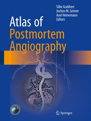 Atlas of Postmortem Angiography - Axel Heinemann