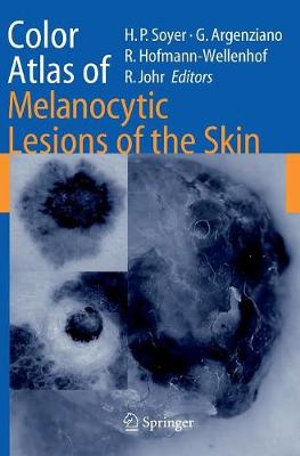 Color Atlas of Melanocytic Lesions of the Skin - H. Peter Soyer