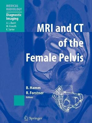 MRI and CT of the Female Pelvis : Diagnostic Imaging - Bernd Hamm