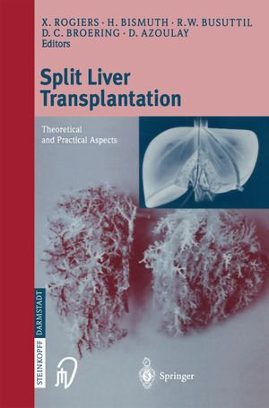 Split liver transplantation : Theoretical and practical aspects - H. Bismuth