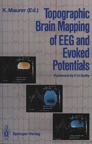 Topographic Brain Mapping of EEG and Evoked Potentials - F.H. Duffy