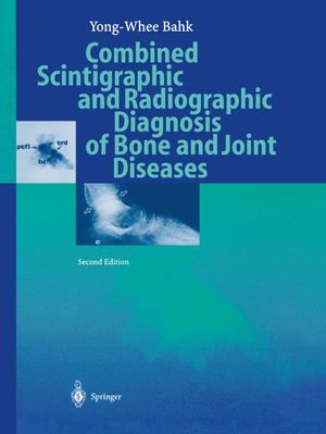 Combined Scintigraphic and Radiographic Diagnosis of Bone and Joint Diseases - M. Lee