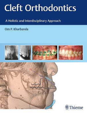 Cleft Orthodontics : A Holistic and Interdisciplinary Approach - Om P. Kharbanda