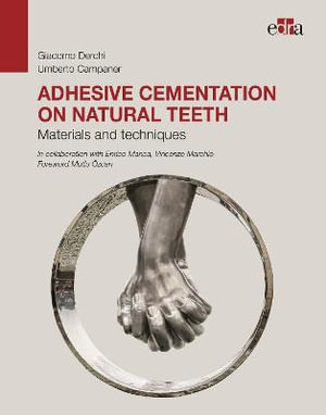 Adhesive cementation on natural teeth - Materials and techniques - Giacomo Derchi