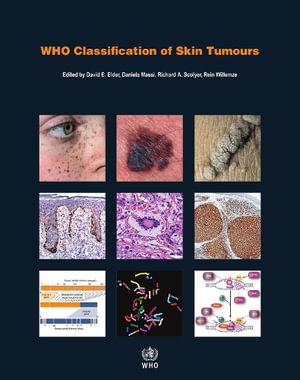 WHO Classification of Skin Tumours : WHO Classification of Tumours, Volume 11 - International Agency for Research on Cancer