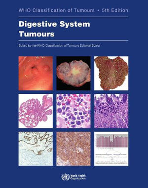 WHO Classification of Tumours. Digestive System Tumours : WHO Classification of Tumours, Volume 1 - International Agency for Research on Cancer