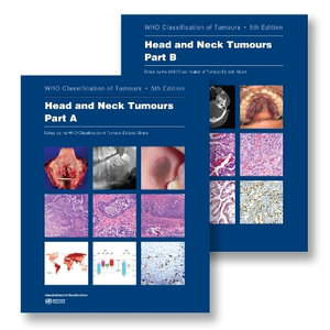 Head and Neck Tumours : Who Classification of Tumours - Who Classification of Tumours Editorial