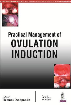 Practical Management of Ovulation Induction - Hemant Deshpande