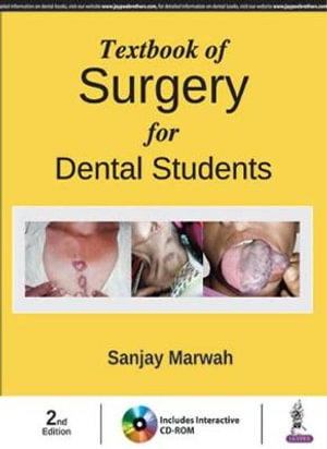 Textbook of Surgery for Dental Students - Sanjay Marwah