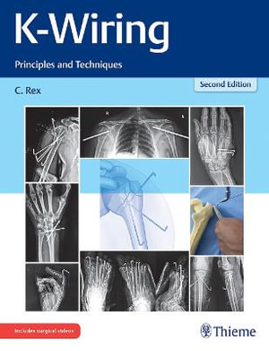 K-Wiring : Principles and Techniques - Chandrabose Rex