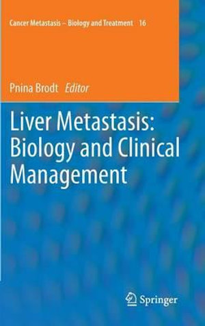 Liver Metastasis : Biology and Clinical Management - Pnina Brodt